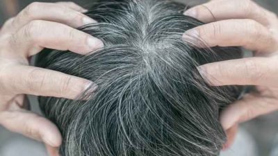 Fakta Menarik Seputar Rambut Beruban